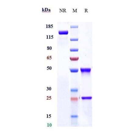 SDS-PAGE - Mibavademab Biosimilar - Anti-Leptin Receptor Antibody - Low endotoxin, Azide free (A323577) - Antibodies.com