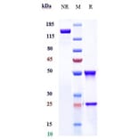 SDS-PAGE - Mibavademab Biosimilar - Anti-Leptin Receptor Antibody - Low endotoxin, Azide free (A323577) - Antibodies.com
