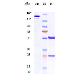 SDS-PAGE - Mipasetamab Biosimilar - Anti-Axl Antibody - Low endotoxin, Azide free (A323579) - Antibodies.com