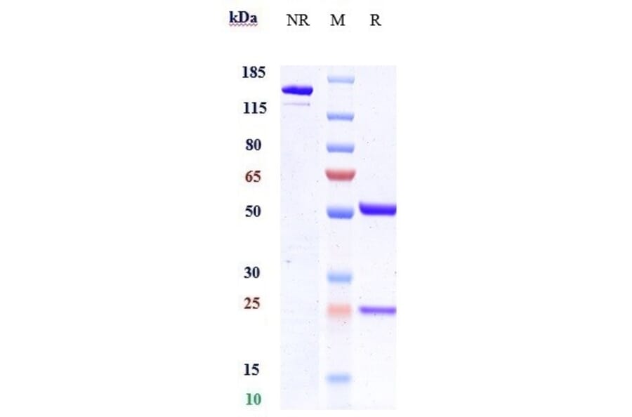 SDS-PAGE - Mipasetamab Biosimilar - Anti-Axl Antibody - Low endotoxin, Azide free (A323579) - Antibodies.com