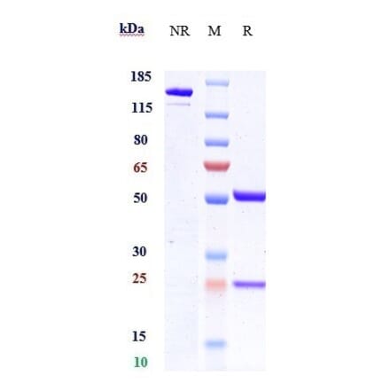 SDS-PAGE - Mipasetamab Biosimilar - Anti-Axl Antibody - Low endotoxin, Azide free (A323579) - Antibodies.com