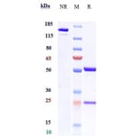 SDS-PAGE - Mipasetamab Biosimilar - Anti-Axl Antibody - Low endotoxin, Azide free (A323579) - Antibodies.com