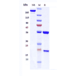 SDS-PAGE - Modotuximab Biosimilar - Anti-EGFR Antibody - Low endotoxin, Azide free (A323586) - Antibodies.com