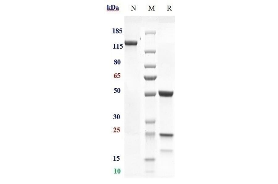 SDS-PAGE - Murlentamab Biosimilar - Anti-AMHR2 Antibody - Low endotoxin, Azide free (A323592) - Antibodies.com