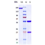 SDS-PAGE - Naratuximab Biosimilar - Anti-CD37 Antibody - Low endotoxin, Azide free (A323596) - Antibodies.com