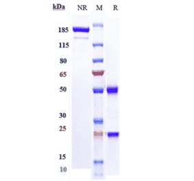 SDS-PAGE - Necitumumab Biosimilar - Anti-EGFR Antibody - Low endotoxin, Azide free (A323601) - Antibodies.com