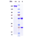 SDS-PAGE - Necitumumab Biosimilar - Anti-EGFR Antibody - Low endotoxin, Azide free (A323601) - Antibodies.com