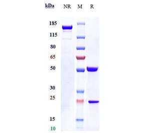 SDS-PAGE - Nemolizumab Biosimilar - Anti-IL-31RA Antibody - Low endotoxin, Azide free (A323603) - Antibodies.com