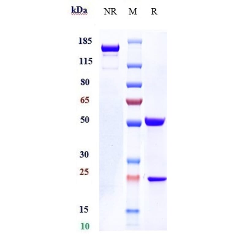 SDS-PAGE - Nemolizumab Biosimilar - Anti-IL-31RA Antibody - Low endotoxin, Azide free (A323603) - Antibodies.com