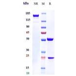 SDS-PAGE - Nemolizumab Biosimilar - Anti-IL-31RA Antibody - Low endotoxin, Azide free (A323603) - Antibodies.com