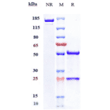 SDS-PAGE - Nesvacumab Biosimilar - Anti-Angiopoietin 2/ANG2 Antibody - Low endotoxin, Azide free (A323604) - Antibodies.com
