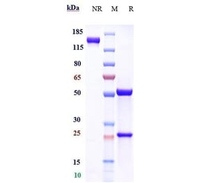 SDS-PAGE - Anti-Albumin Antibody [Research Grade Biosimilar] - Low endotoxin, Azide free (A323612) - Antibodies.com
