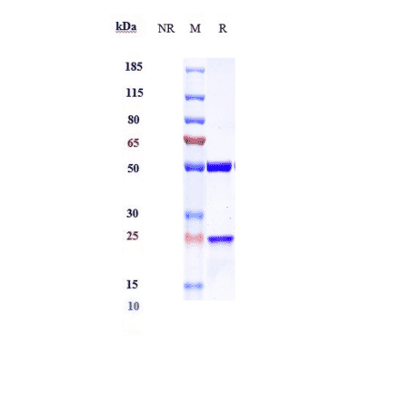 SDS-PAGE - Ociperlimab Biosimilar - Anti-TIGIT Antibody - Low endotoxin, Azide free (A323617) - Antibodies.com