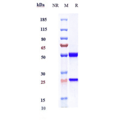 SDS-PAGE - Ocrelizumab Biosimilar - Anti-CD20 Antibody - Low endotoxin, Azide free (A323618) - Antibodies.com