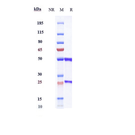 SDS-PAGE - Olinvacimab Biosimilar - Anti-VEGF Receptor 2 Antibody - Low endotoxin, Azide free (A323622) - Antibodies.com