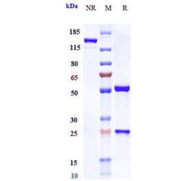 SDS-PAGE - Olokizumab Biosimilar - Anti-IL-6 Antibody - Low endotoxin, Azide free (A323623) - Antibodies.com