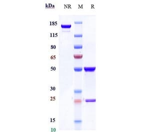 SDS-PAGE - Onartuzumab Biosimilar - Anti-Met (c-Met) Antibody - Low endotoxin, Azide free (A323626) - Antibodies.com
