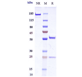 SDS-PAGE - Ongericimab Biosimilar - Anti-PCSK9 Antibody - Low endotoxin, Azide free (A323627) - Antibodies.com