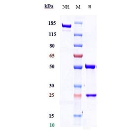 SDS-PAGE - Ontuxizumab Biosimilar - Anti-TEM1 Antibody - Low endotoxin, Azide free (A323629) - Antibodies.com
