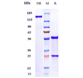 SDS-PAGE - Onvatilimab Biosimilar - Anti-VISTA Antibody - Low endotoxin, Azide free (A323630) - Antibodies.com