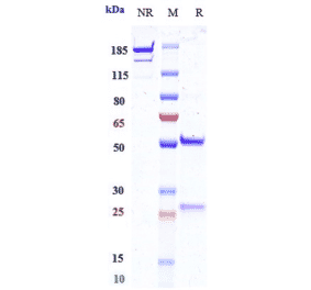 SDS-PAGE - Opucolimab Biosimilar - Anti-PD-L1 Antibody - Low endotoxin, Azide free (A323633) - Antibodies.com
