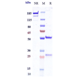 SDS-PAGE - Opucolimab Biosimilar - Anti-PD-L1 Antibody - Low endotoxin, Azide free (A323633) - Antibodies.com