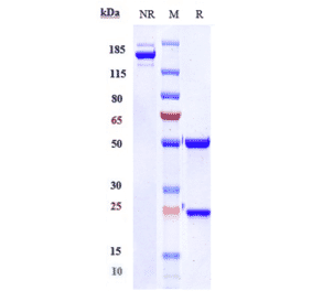 SDS-PAGE - Ordesekimab Biosimilar - Anti-IL-15 Antibody - Low endotoxin, Azide free (A323634) - Antibodies.com