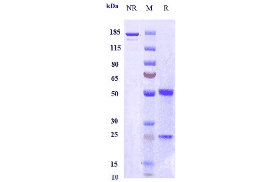 SDS-PAGE - Orilanolimab Biosimilar - Anti-FCGRT/FCRN Antibody - Low endotoxin, Azide free (A323637) - Antibodies.com