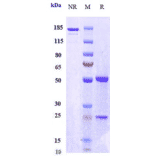 SDS-PAGE - Orilanolimab Biosimilar - Anti-FCGRT/FCRN Antibody - Low endotoxin, Azide free (A323637) - Antibodies.com