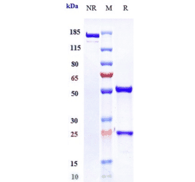 SDS-PAGE - Osocimab Biosimilar - Anti-Factor XI Antibody - Low endotoxin, Azide free (A323639) - Antibodies.com