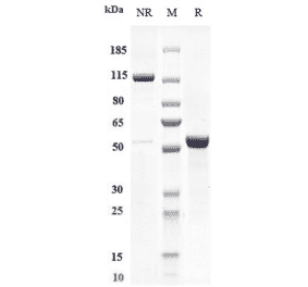 SDS-PAGE - Otlertuzumab Biosimilar - Anti-CD37 Antibody - Low endotoxin, Azide free (A323642) - Antibodies.com