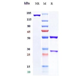 SDS-PAGE - Pacmilimab Biosimilar - Anti-PD-L1 Antibody - Low endotoxin, Azide free (A323647) - Antibodies.com