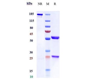 SDS-PAGE - Pascolizumab Biosimilar - Anti-IL-4 Antibody - Low endotoxin, Azide free (A323651) - Antibodies.com