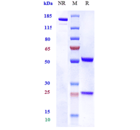 SDS-PAGE - Pateclizumab Biosimilar - Anti-TNF beta Antibody - Low endotoxin, Azide free (A323652) - Antibodies.com