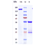 SDS-PAGE - Pertuzumab Biosimilar - Anti-ErbB2/HER2 Antibody - Low endotoxin, Azide free (A323661) - Antibodies.com