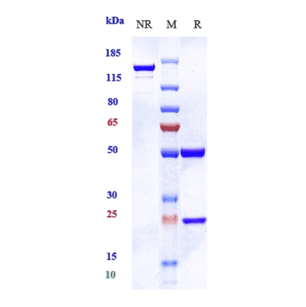 SDS-PAGE - Pimurutamab Biosimilar - Anti-EGFR Antibody - Low endotoxin, Azide free (A323666) - Antibodies.com