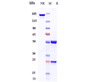 SDS-PAGE - Polatuzumab Biosimilar - Anti-CD79b Antibody - Low endotoxin, Azide free (A323672) - Antibodies.com