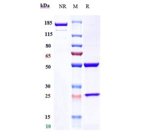 SDS-PAGE - Prasinezumab Biosimilar - Anti-alpha Synuclein Antibody - Low endotoxin, Azide free (A323678) - Antibodies.com