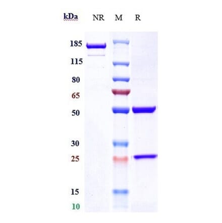 SDS-PAGE - Prasinezumab Biosimilar - Anti-alpha Synuclein Antibody - Low endotoxin, Azide free (A323678) - Antibodies.com