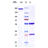 SDS-PAGE - Prasinezumab Biosimilar - Anti-alpha Synuclein Antibody - Low endotoxin, Azide free (A323678) - Antibodies.com