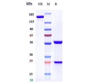 SDS-PAGE - Quetmolimab Biosimilar - Anti-CX3CL1 Antibody - Low endotoxin, Azide free (A323683) - Antibodies.com
