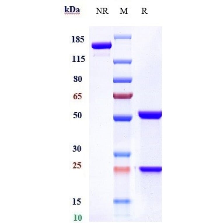 SDS-PAGE - Quetmolimab Biosimilar - Anti-CX3CL1 Antibody - Low endotoxin, Azide free (A323683) - Antibodies.com