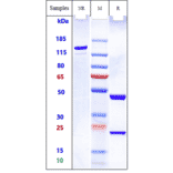 SDS-PAGE - Quilizumab Biosimilar - Anti-Human IgE (M1 prime) Antibody - Low endotoxin, Azide free (A323684) - Antibodies.com