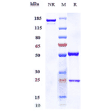 SDS-PAGE - Racotumomab Biosimilar - Anti-ST3GAL5 Antibody - Low endotoxin, Azide free (A323685) - Antibodies.com