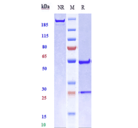 SDS-PAGE - Radretumab Biosimilar - Anti-Fibronectin Antibody - Low endotoxin, Azide free (A323686) - Antibodies.com