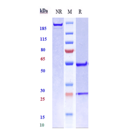 SDS-PAGE - Radretumab Biosimilar - Anti-Fibronectin Antibody - Low endotoxin, Azide free (A323686) - Antibodies.com