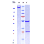 SDS-PAGE - Radretumab Biosimilar - Anti-Fibronectin Antibody - Low endotoxin, Azide free (A323686) - Antibodies.com