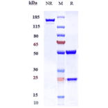 SDS-PAGE - Ragifilimab Biosimilar - Anti-GITR Antibody - Low endotoxin, Azide free (A323688) - Antibodies.com