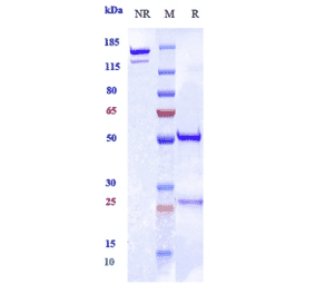 SDS-PAGE - Ralpancizumab Biosimilar - Anti-PCSK9 Antibody - Low endotoxin, Azide free (A323689) - Antibodies.com