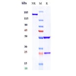 SDS-PAGE - Ramucirumab Biosimilar - Anti-VEGF Receptor 2 Antibody - Low endotoxin, Azide free (A323690) - Antibodies.com